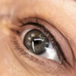 What colour Eyeliner tattooing makes you look younger?